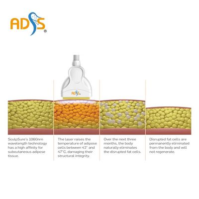1060nm Cryolipolysis آلة التخسيس 4 مقابض آلة التخسيس بالليزر ديود